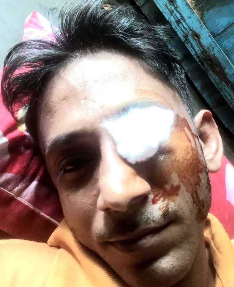 যুবক আহত