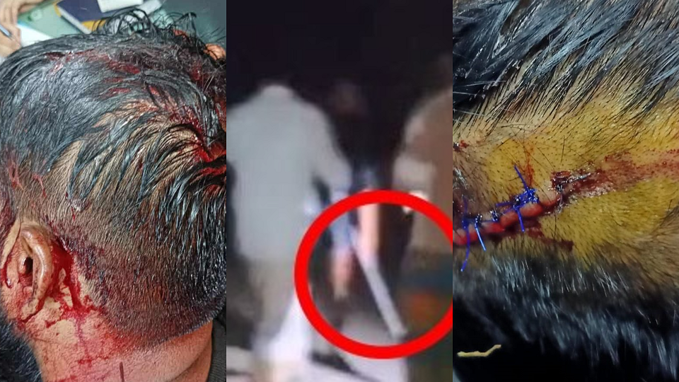 বিচার চাওয়ার কুপিয়ে জখম